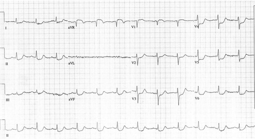 mr08162013p2