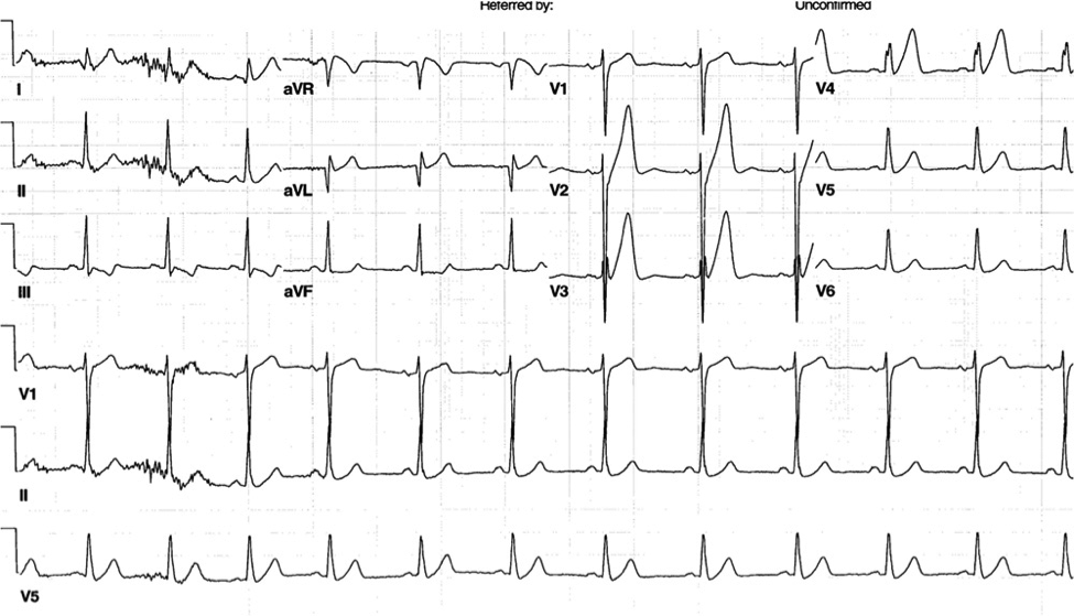 mr08162013p3